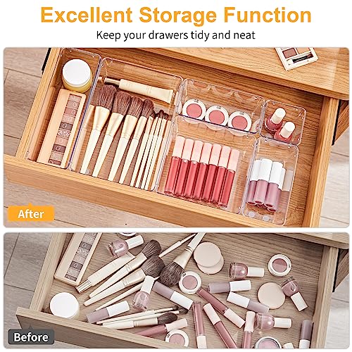 22-Piece Drawer Organizer with Non-Slip Silicone Pads, 5-Size - view 4